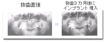 症例