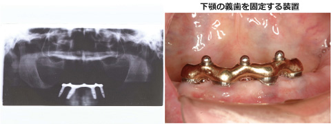 症例