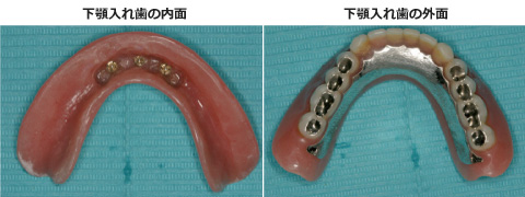 症例