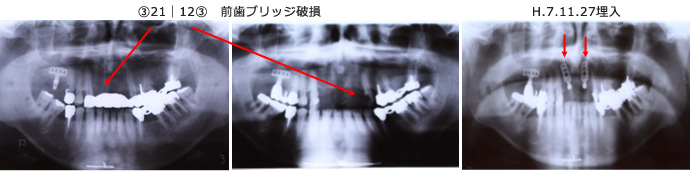 症例