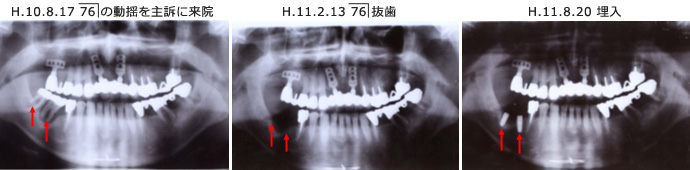 症例