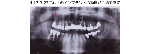 症例