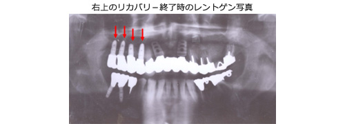 症例