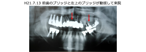 症例